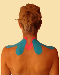 Bild eines Gipsabdruck eines Schwangerenbauches